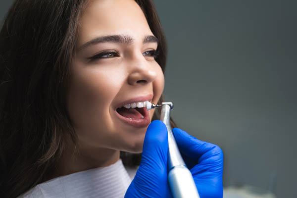 Professional Dental Cleaning FAQs