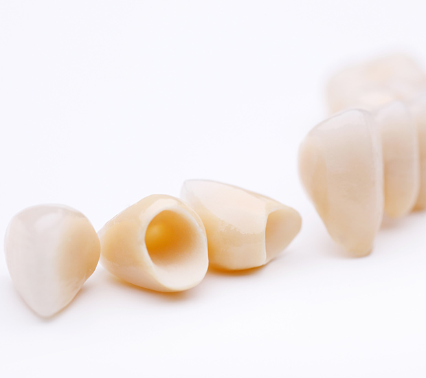 Fontana Dental Crowns and Dental Bridges