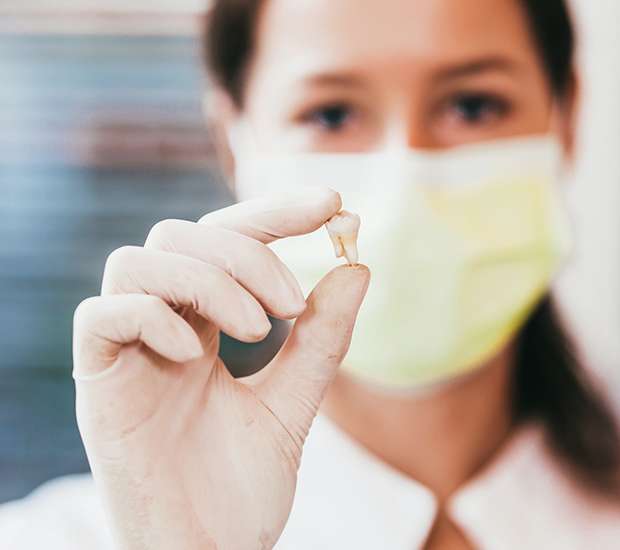 Fontana Tooth Extraction